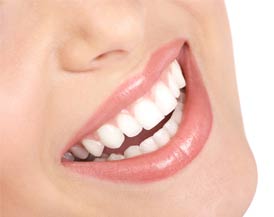 Oyster Point Dental - Professional Teeth Whitening