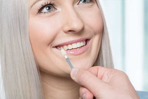 Oyster Point Dentistry - Dental Veneers
